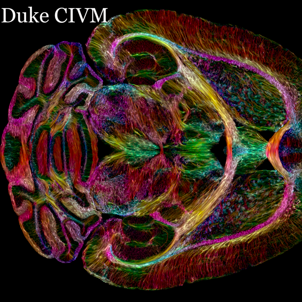 UTHSC researchers are part of a decades-long project to significantly improve brain imaging