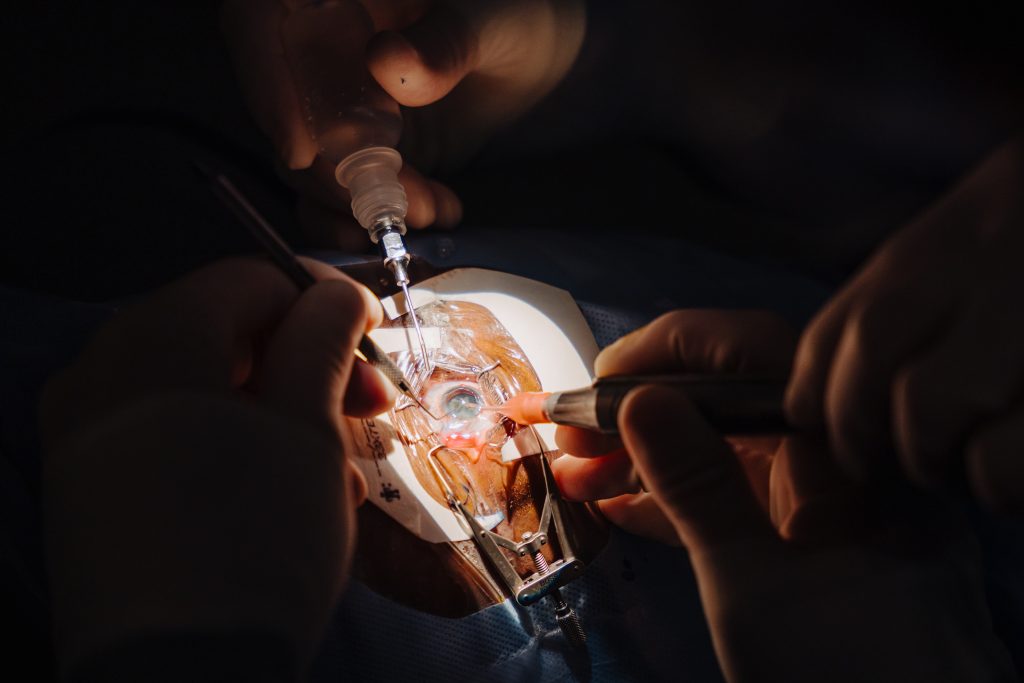 Photo of eye during surgery